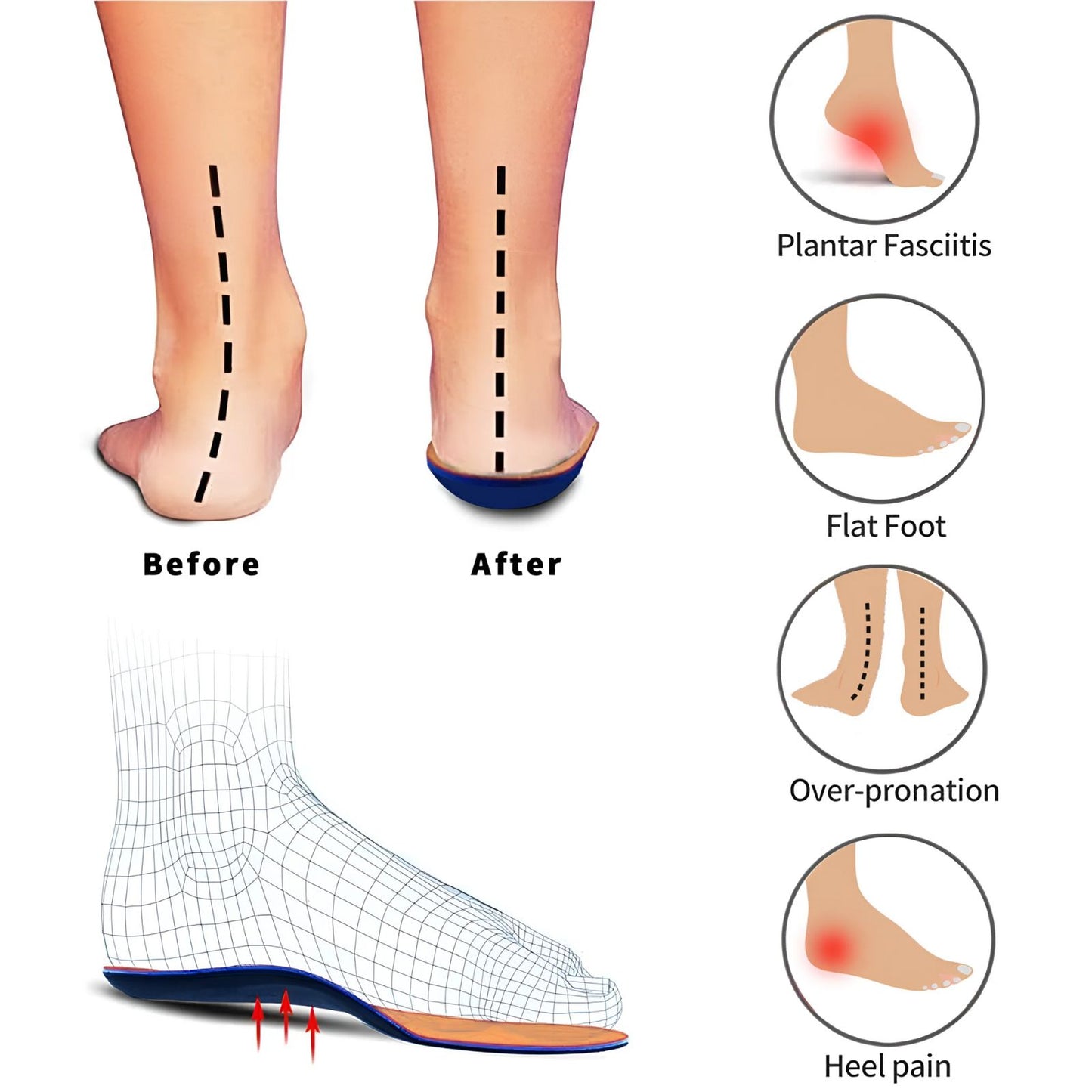 GEIASOU Orthotic Insoles Comfort Memory Foam Arch Support Pain Relief